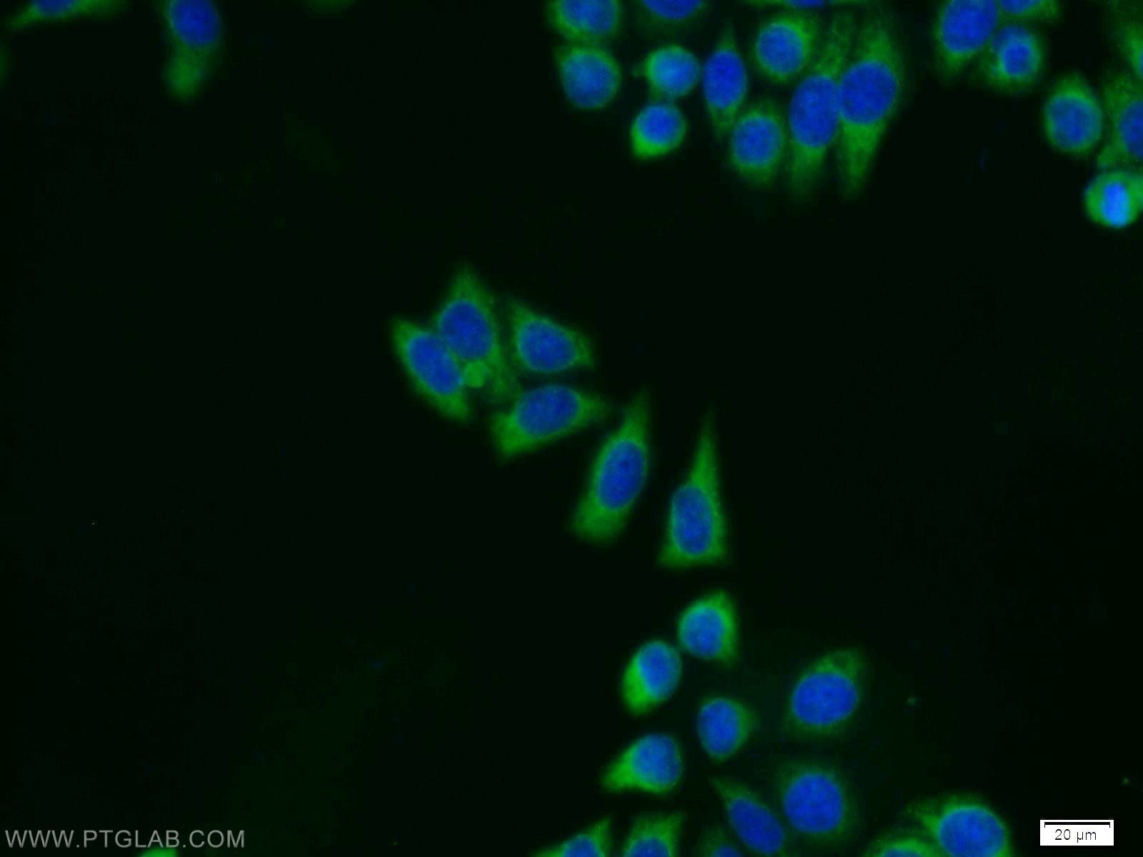 Immunofluorescence (IF) / fluorescent staining of MCF-7 cells using ERK1/2 Polyclonal antibody (11257-1-AP)