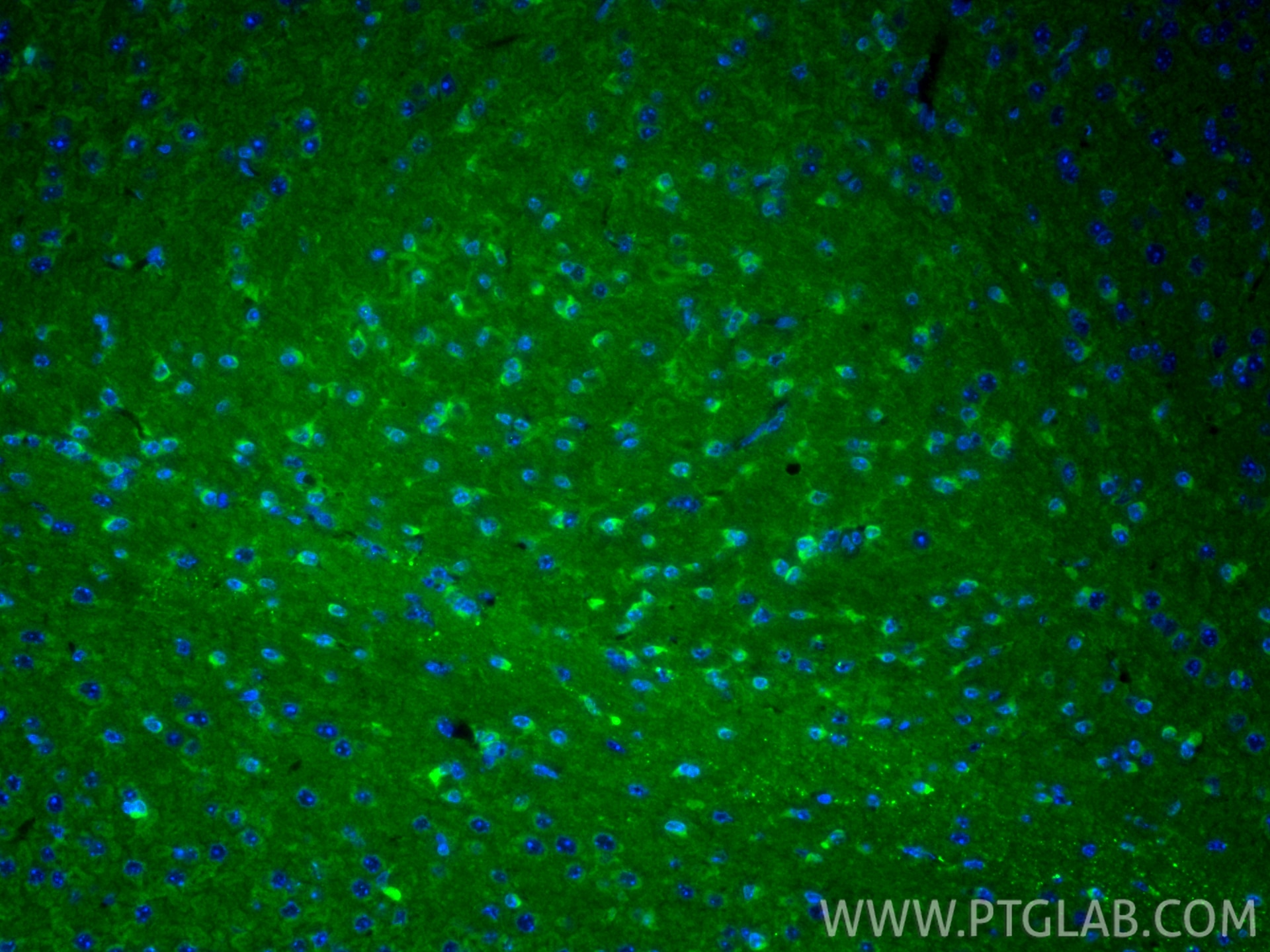 IF Staining of mouse brain using 11257-1-AP Immunofluorescence (IF) / fluorescent staining of mouse brain tissue using ERK1/2 Polyclonal antibody (11257-1-AP)