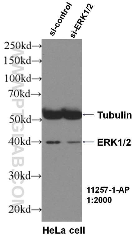 Western Blot (WB) analysis of HeLa cells using ERK1/2 Polyclonal antibody (11257-1-AP)