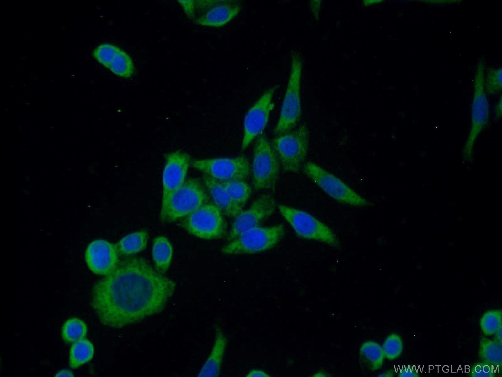 Immunofluorescence (IF) / fluorescent staining of HeLa cells using ERK1/2 Polyclonal antibody (16443-1-AP)
