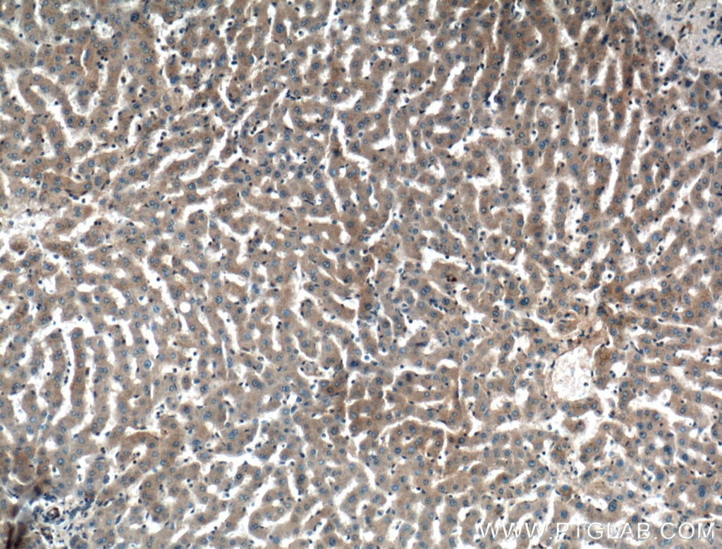 Immunohistochemistry (IHC) staining of human liver tissue using ERK1/2 Polyclonal antibody (16443-1-AP)