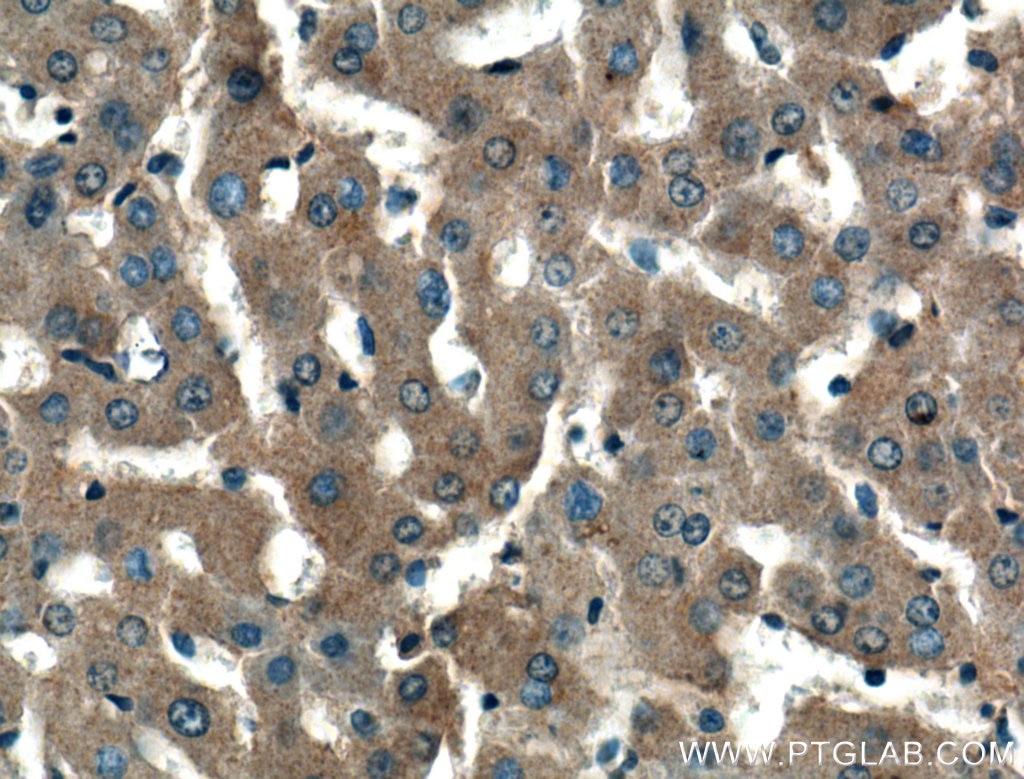 Immunohistochemistry (IHC) staining of human liver tissue using ERK1/2 Polyclonal antibody (16443-1-AP)