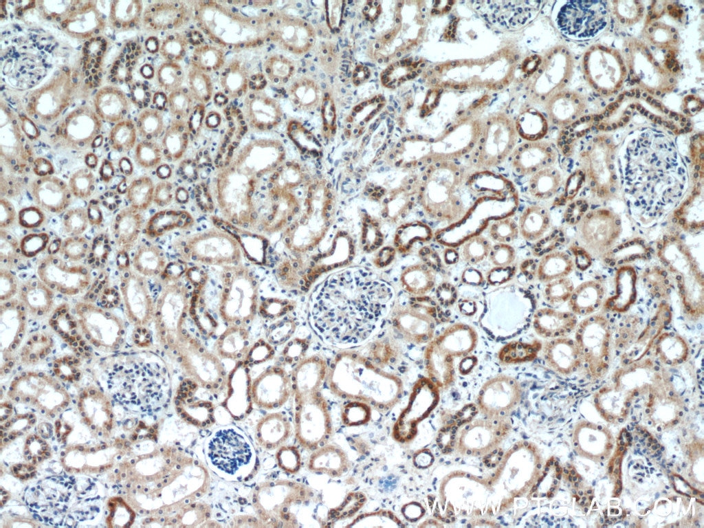 IHC staining of human kidney using 16443-1-AP