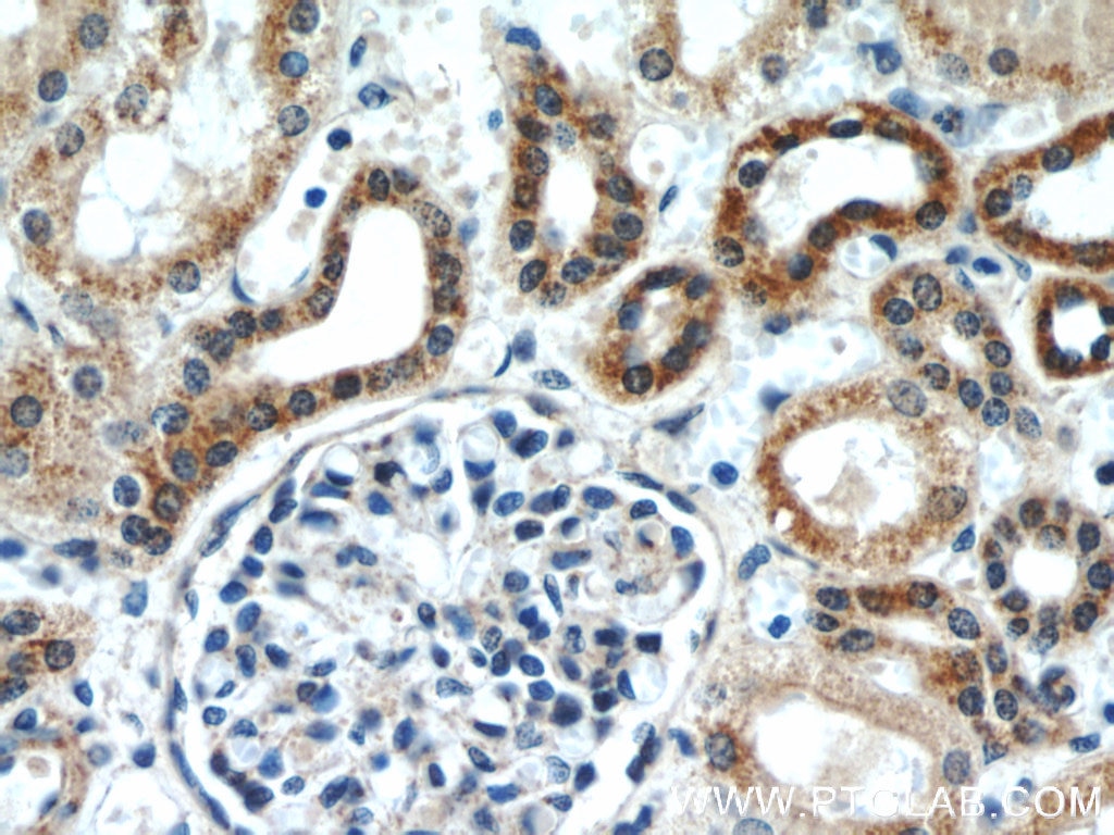 Immunohistochemistry (IHC) staining of human kidney tissue using ERK1/2 Polyclonal antibody (16443-1-AP)