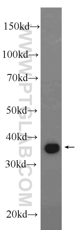 WB analysis of rat kidney using 16443-1-AP