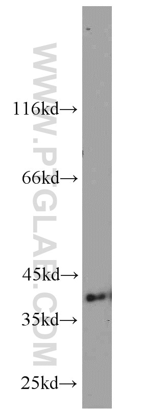 Western Blot (WB) analysis of A431 cells using ERK1/2 Polyclonal antibody (16443-1-AP)
