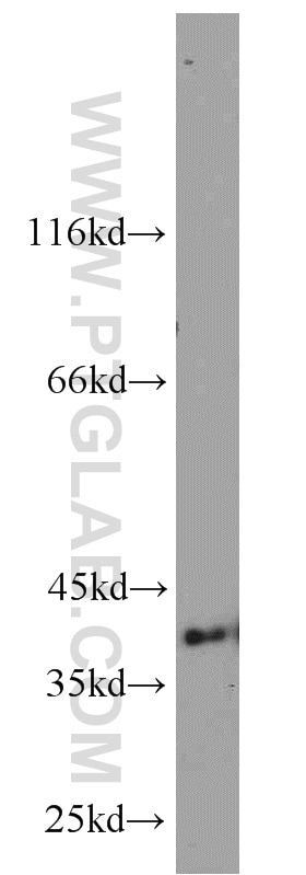 WB analysis of A431 using 16443-1-AP