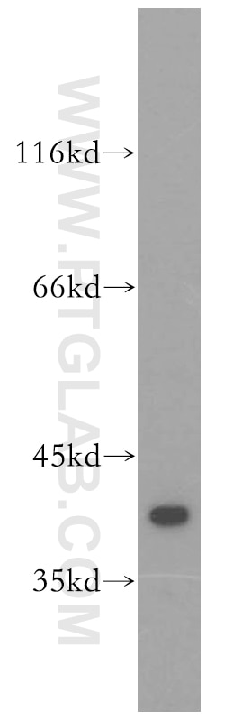 ERK1/2 Polyclonal antibody