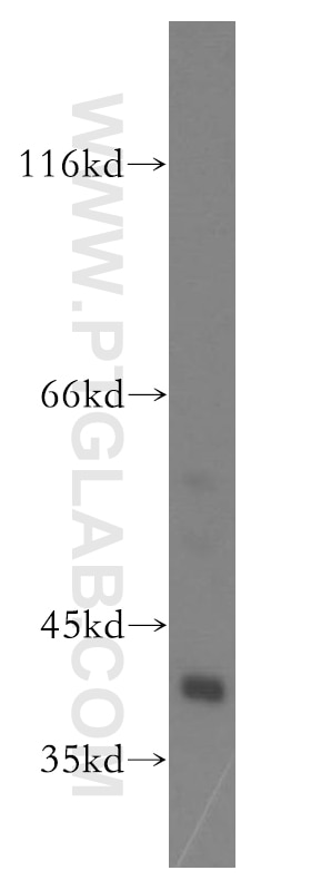 Western Blot (WB) analysis of mouse kidney tissue using ERK1/2 Polyclonal antibody (16443-1-AP)