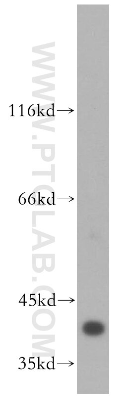 Western Blot (WB) analysis of HEK-293 cells using ERK1/2 Polyclonal antibody (16443-1-AP)