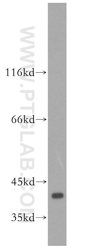 WB analysis of HeLa using 16443-1-AP