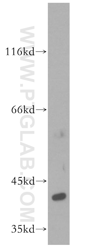 Western Blot (WB) analysis of PC-3 cells using ERK1/2 Polyclonal antibody (16443-1-AP)