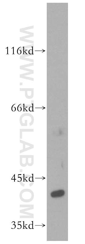 WB analysis of PC-3 using 16443-1-AP