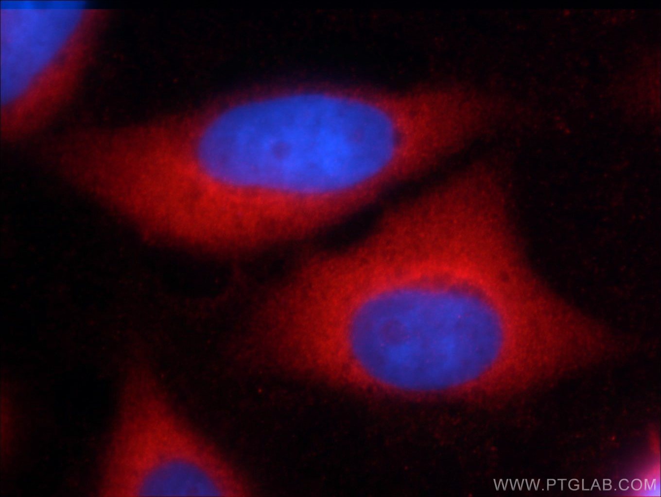 Immunofluorescence (IF) / fluorescent staining of HeLa cells using ERK1/2 Polyclonal antibody (51068-1-AP)