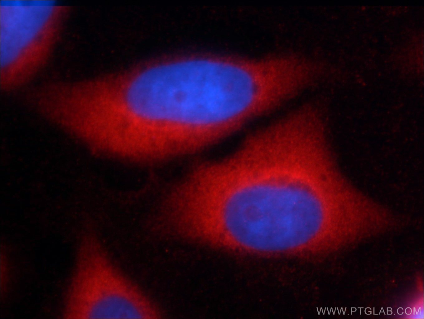 IF Staining of HeLa using 51068-1-AP