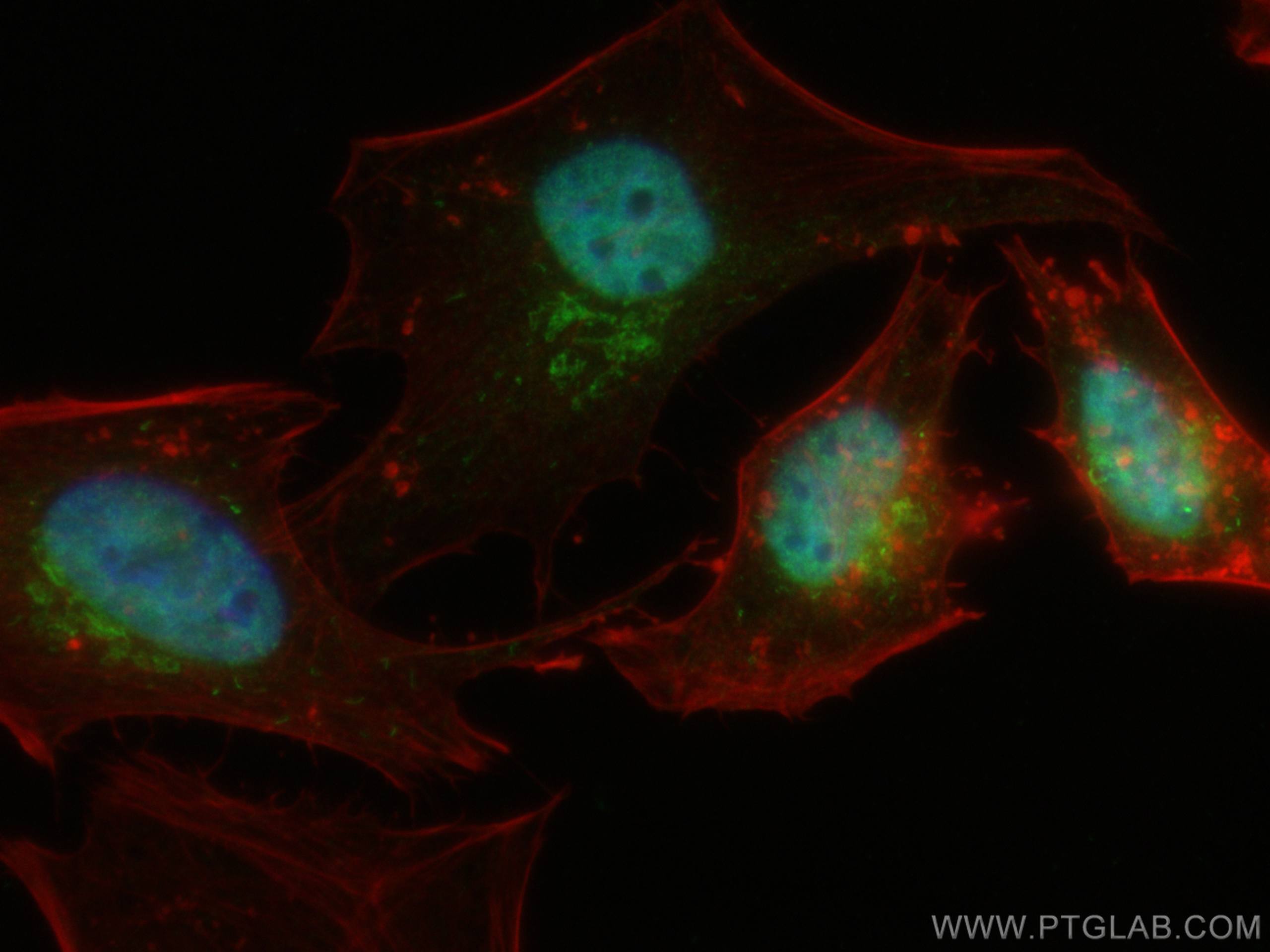 IF Staining of HeLa using 51068-1-AP