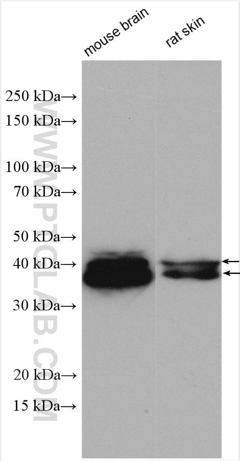 Western Blot (WB) analysis of various lysates using ERK1/2 Polyclonal antibody (51068-1-AP)