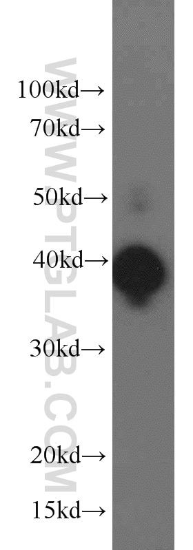 ERK1/2 Polyclonal antibody