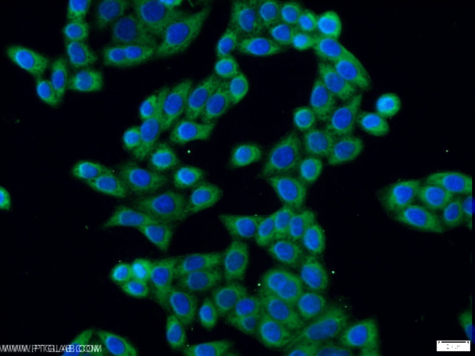 Immunofluorescence (IF) / fluorescent staining of HeLa cells using ERLIN1 Polyclonal antibody (17311-1-AP)