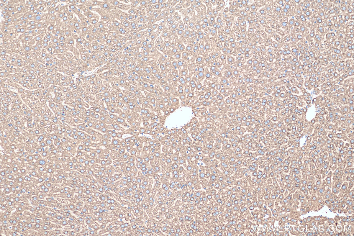 Immunohistochemistry (IHC) staining of mouse liver tissue using ERLIN1 Polyclonal antibody (17311-1-AP)