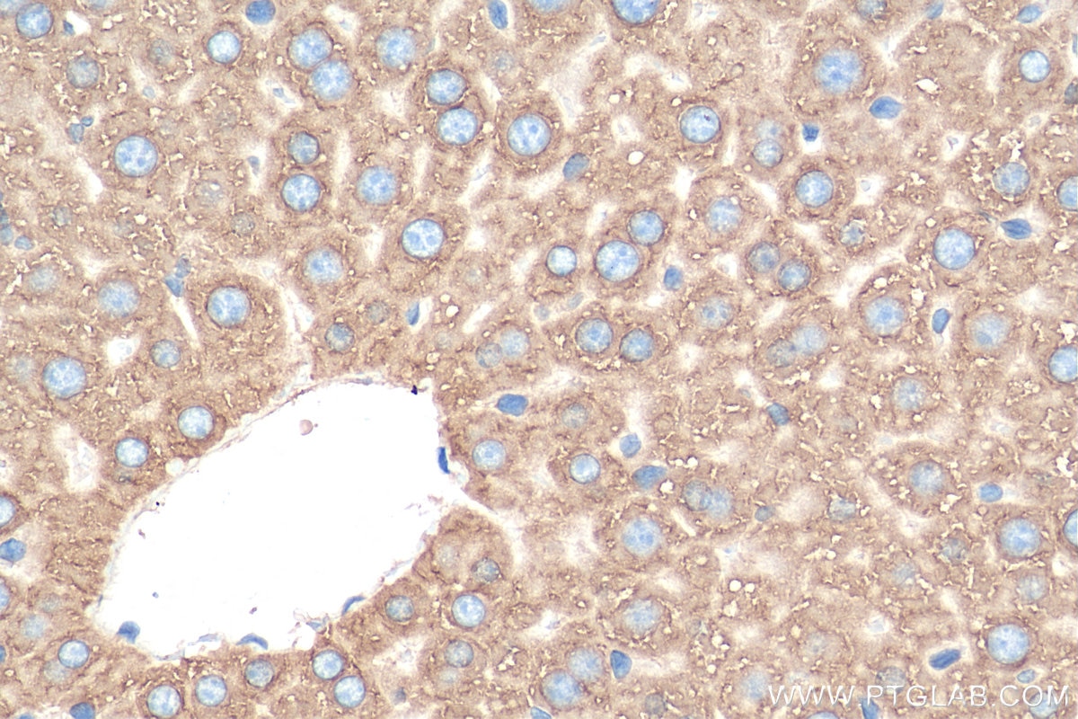Immunohistochemistry (IHC) staining of mouse liver tissue using ERLIN1 Polyclonal antibody (17311-1-AP)