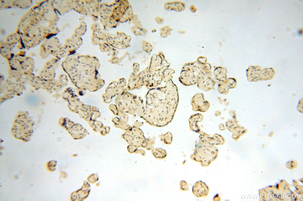 Immunohistochemistry (IHC) staining of human placenta tissue using ERLIN1 Polyclonal antibody (17311-1-AP)