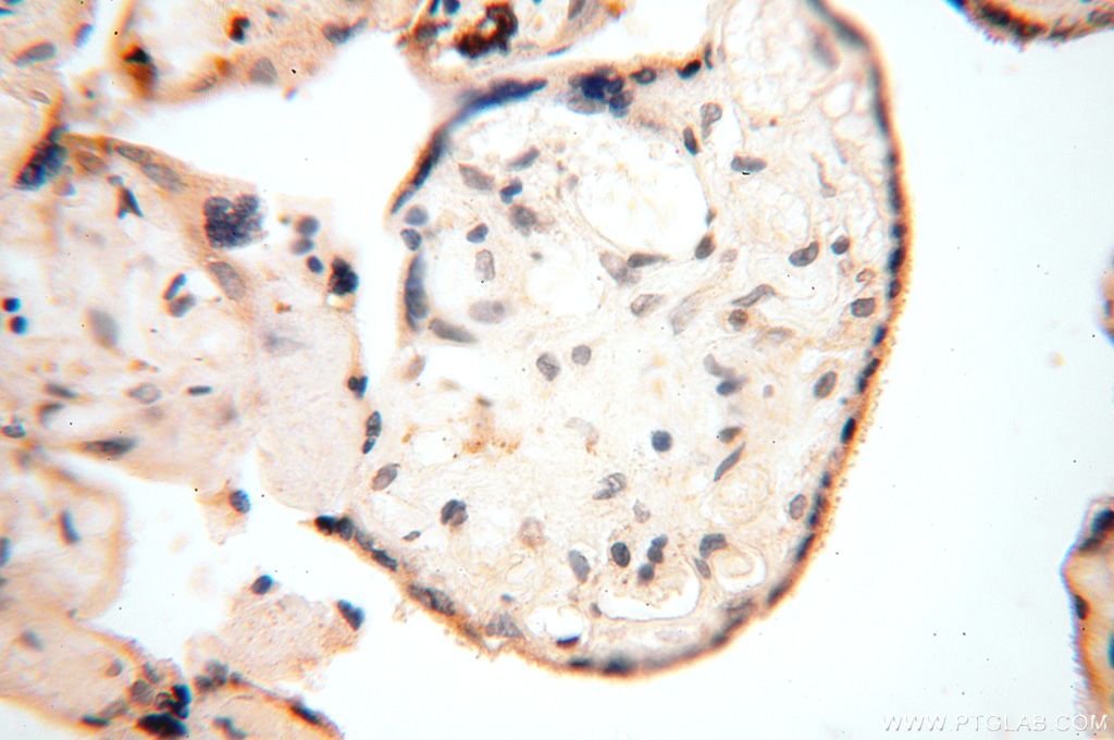 Immunohistochemistry (IHC) staining of human placenta tissue using ERLIN1 Polyclonal antibody (17311-1-AP)