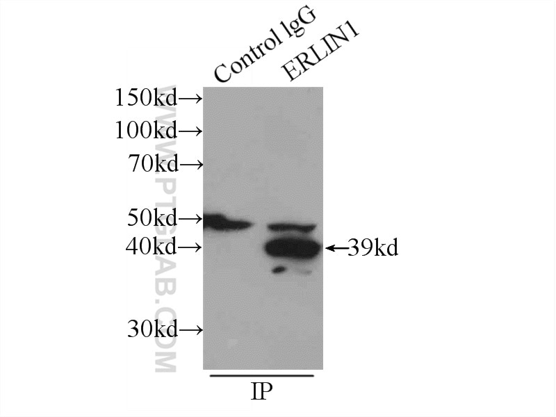 Immunoprecipitation (IP) experiment of mouse heart tissue using ERLIN1 Polyclonal antibody (17311-1-AP)