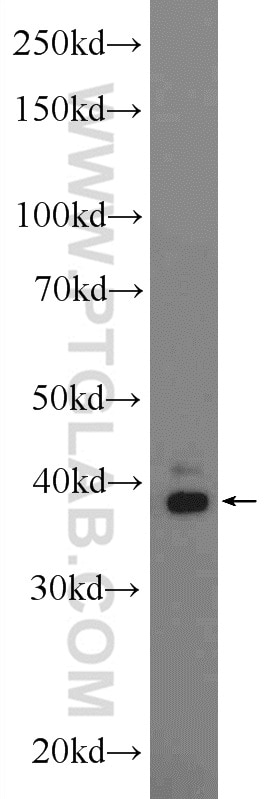 Western Blot (WB) analysis of COLO 320 cells using ERLIN1 Polyclonal antibody (17311-1-AP)