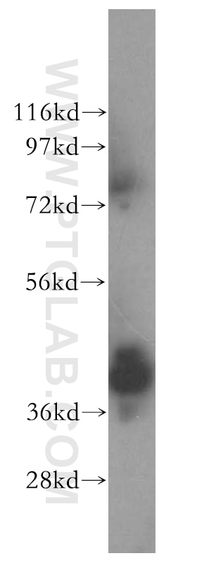 Western Blot (WB) analysis of human kidney tissue using ERLIN1 Polyclonal antibody (17311-1-AP)