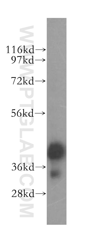 Western Blot (WB) analysis of human ovary cancer cells using ERLIN1 Polyclonal antibody (17311-1-AP)
