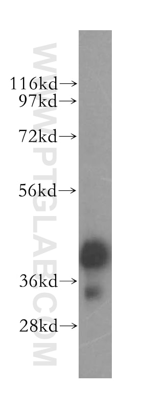 Western Blot (WB) analysis of human ovary cancer tissue using ERLIN1 Polyclonal antibody (17311-1-AP)