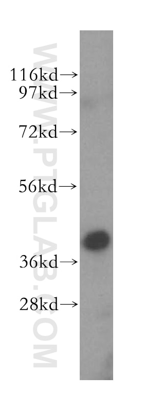 Western Blot (WB) analysis of rat pancreas tissue using ERLIN1 Polyclonal antibody (17311-1-AP)