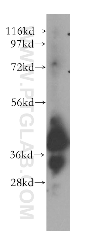 Western Blot (WB) analysis of human brain tissue using ERLIN1 Polyclonal antibody (17311-1-AP)