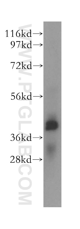 Western Blot (WB) analysis of mouse liver tissue using ERLIN1 Polyclonal antibody (17311-1-AP)