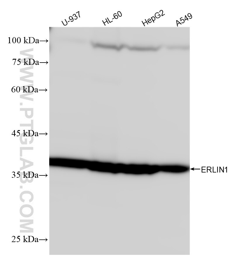 ERLIN1