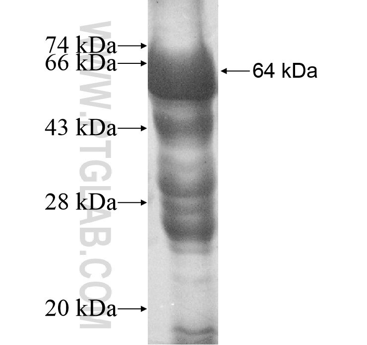 ERLIN1 fusion protein Ag11279 SDS-PAGE