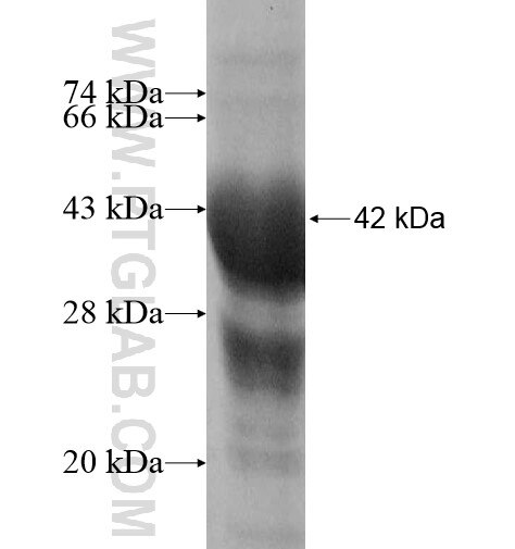 ERLIN1 fusion protein Ag11393 SDS-PAGE
