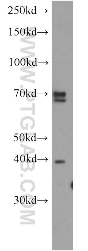 Western Blot (WB) analysis of HeLa cells using ERLIN2 Polyclonal antibody (14781-1-AP)
