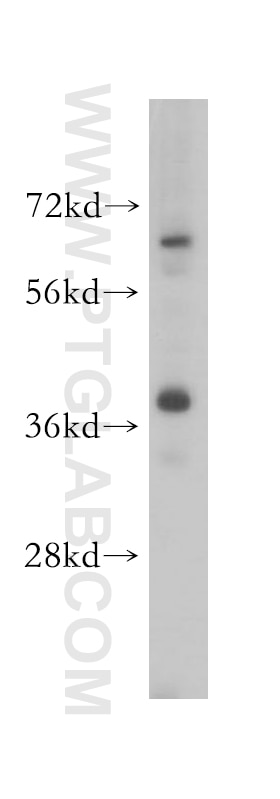 Western Blot (WB) analysis of HeLa cells using ERLIN2 Polyclonal antibody (14781-1-AP)