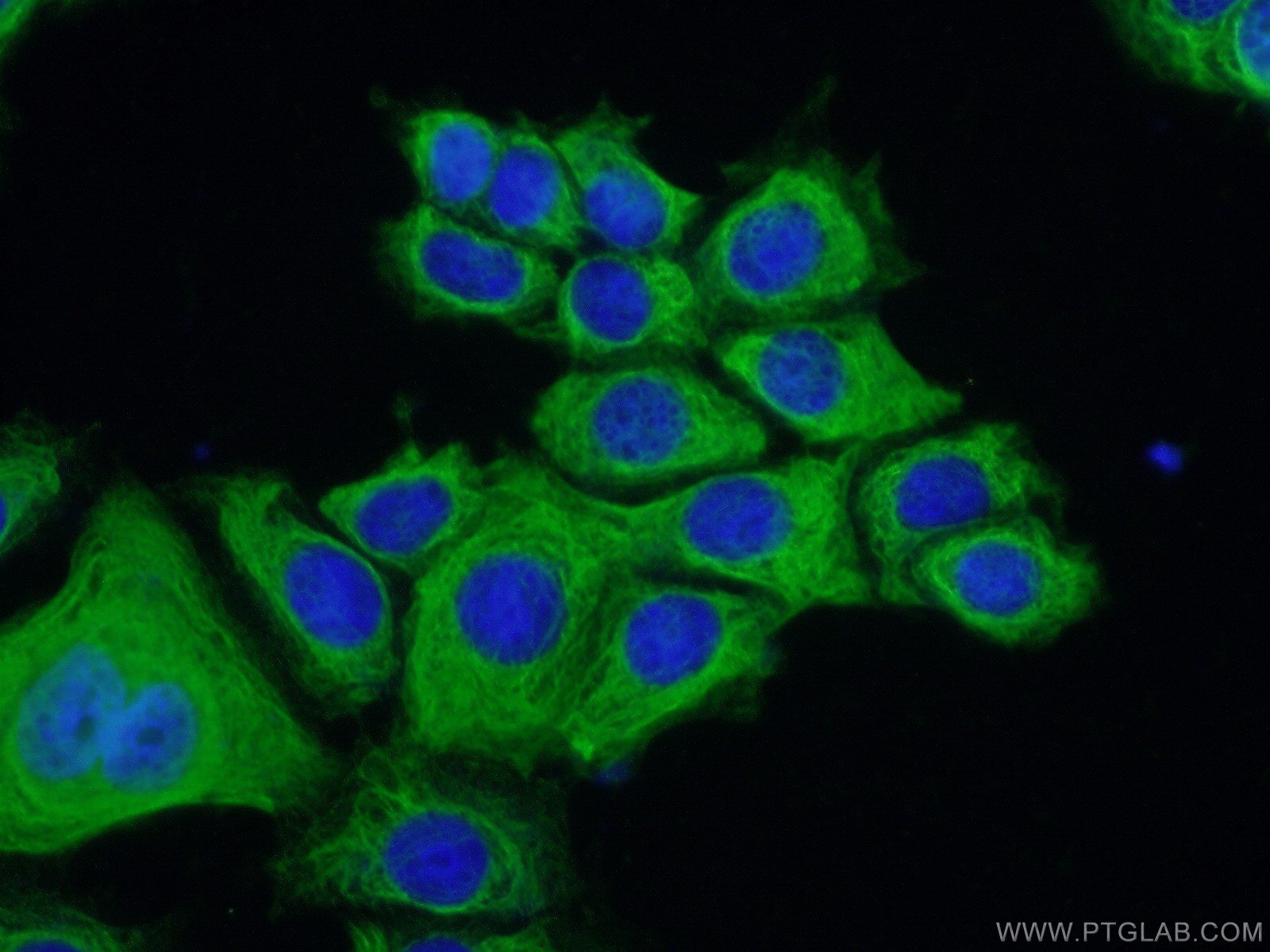 Immunofluorescence (IF) / fluorescent staining of MCF-7 cells using ERMAP Polyclonal antibody (21375-1-AP)