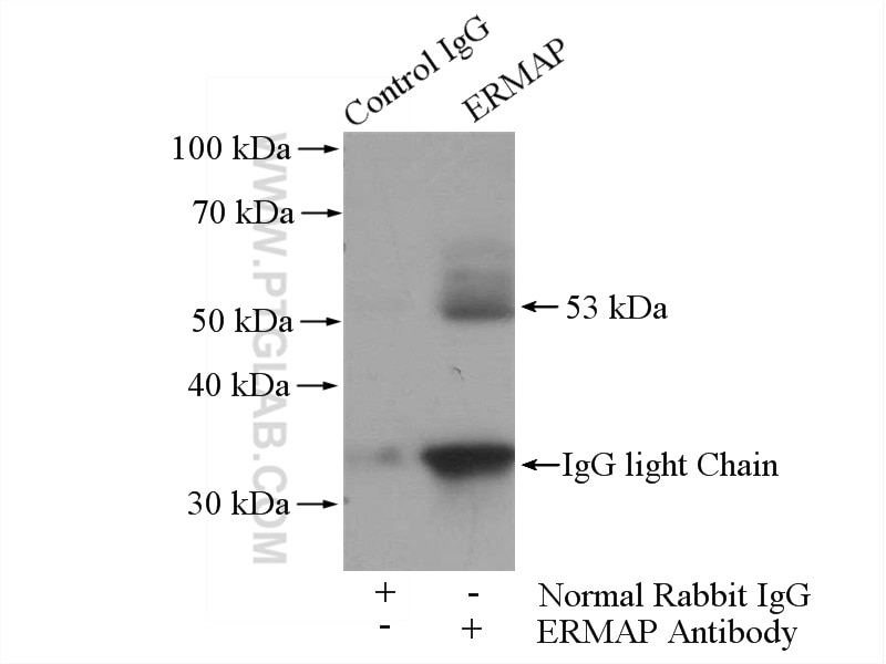 Immunoprecipitation (IP) experiment of MCF-7 cells using ERMAP Polyclonal antibody (21375-1-AP)
