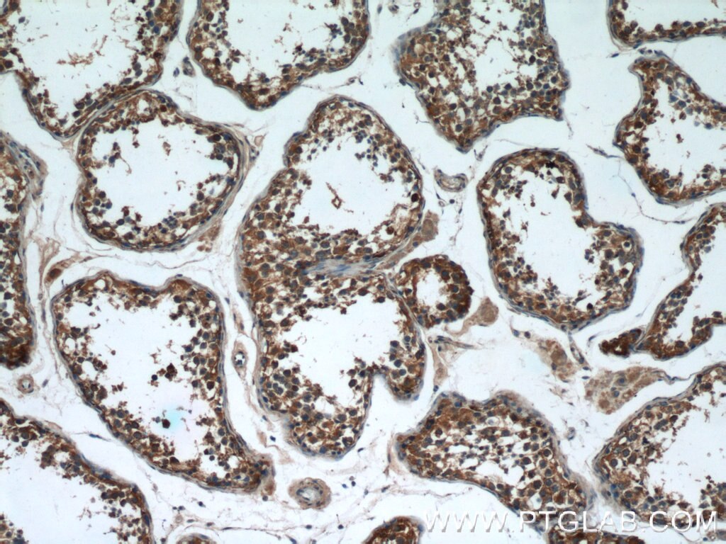 Immunohistochemistry (IHC) staining of human testis tissue using ERMP1 Polyclonal antibody (17321-1-AP)