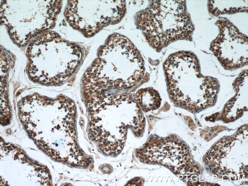 IHC staining of human testis using 17321-1-AP