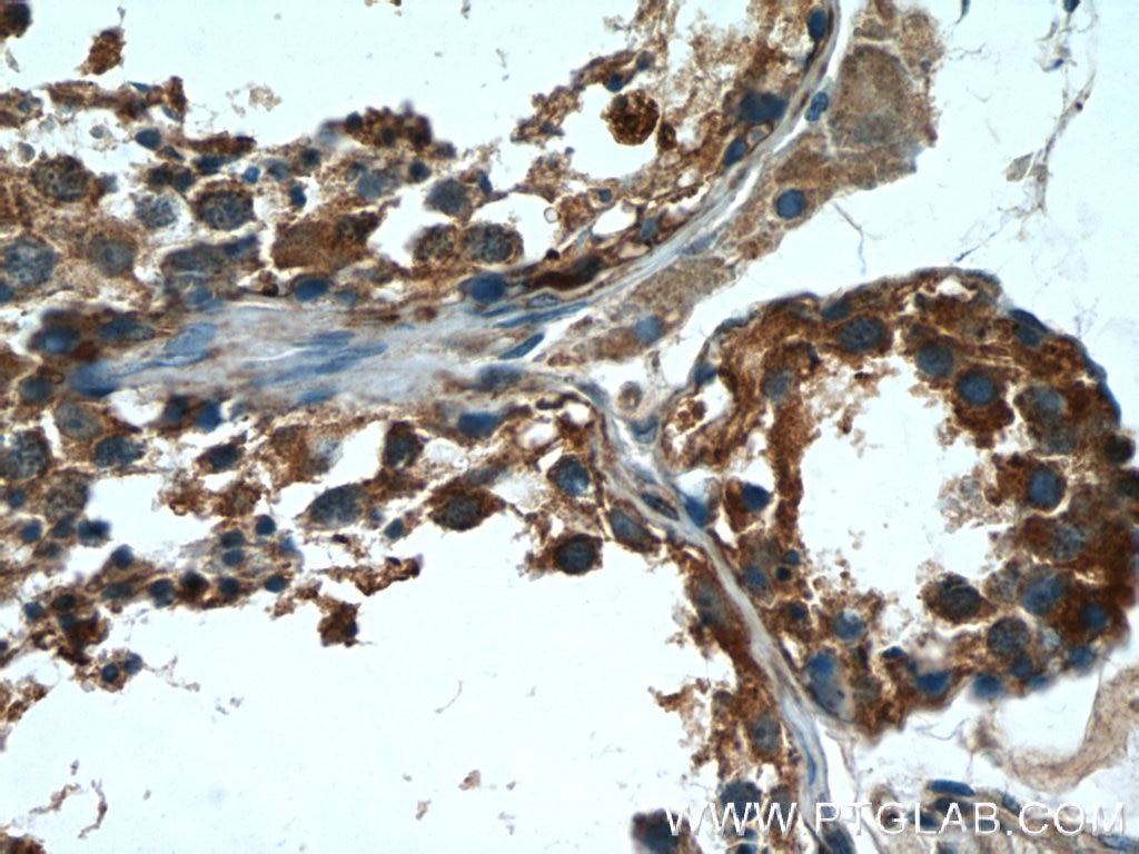 IHC staining of human testis using 17321-1-AP