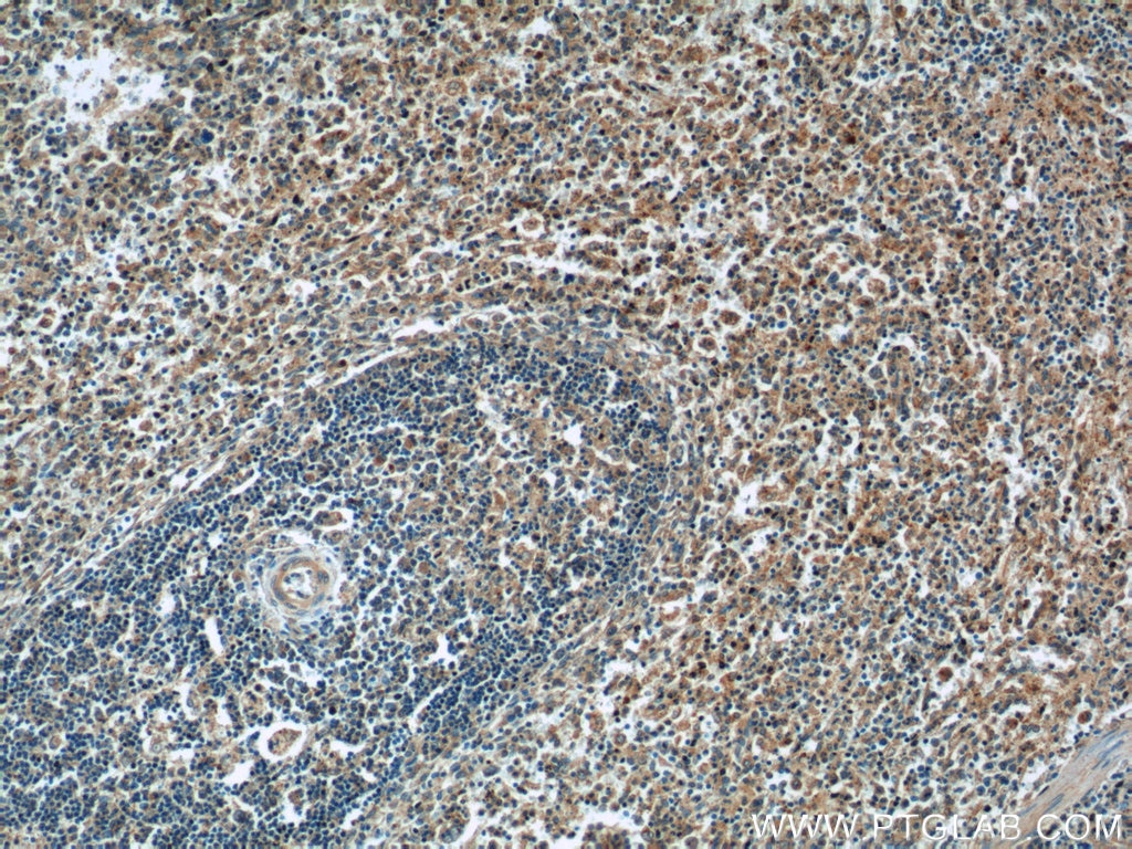 Immunohistochemistry (IHC) staining of human spleen tissue using ERMP1 Polyclonal antibody (17321-1-AP)