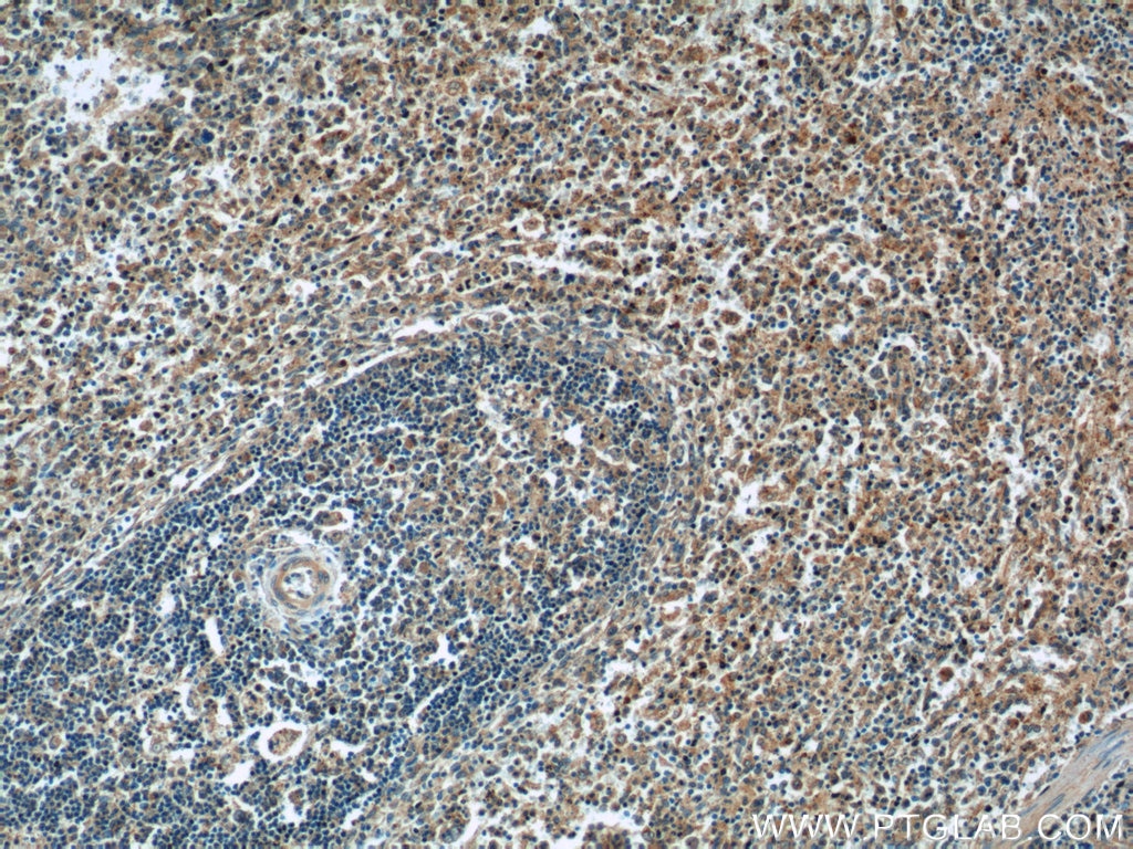 IHC staining of human spleen using 17321-1-AP