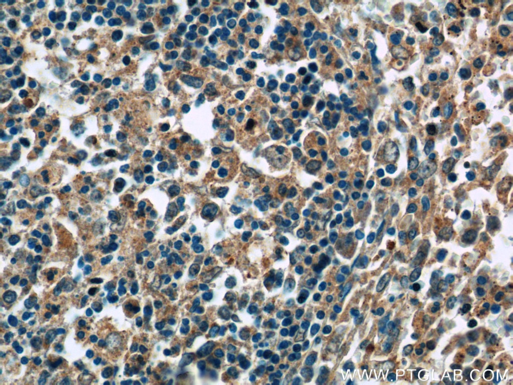 Immunohistochemistry (IHC) staining of human spleen tissue using ERMP1 Polyclonal antibody (17321-1-AP)