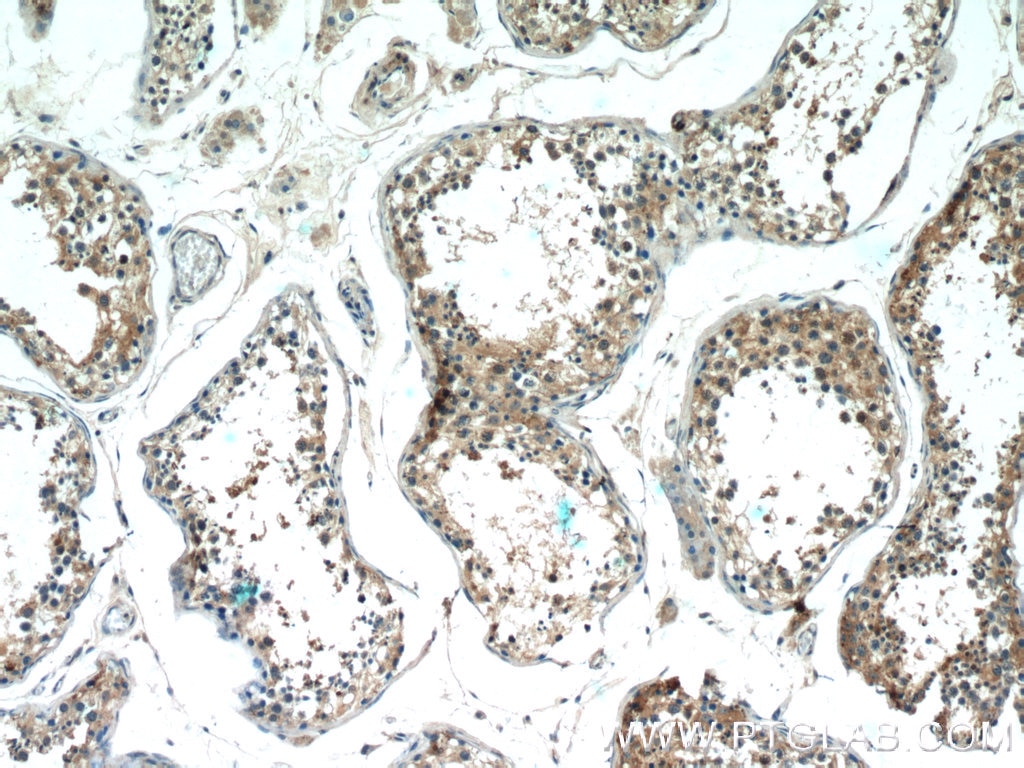 IHC staining of human testis using 17321-1-AP