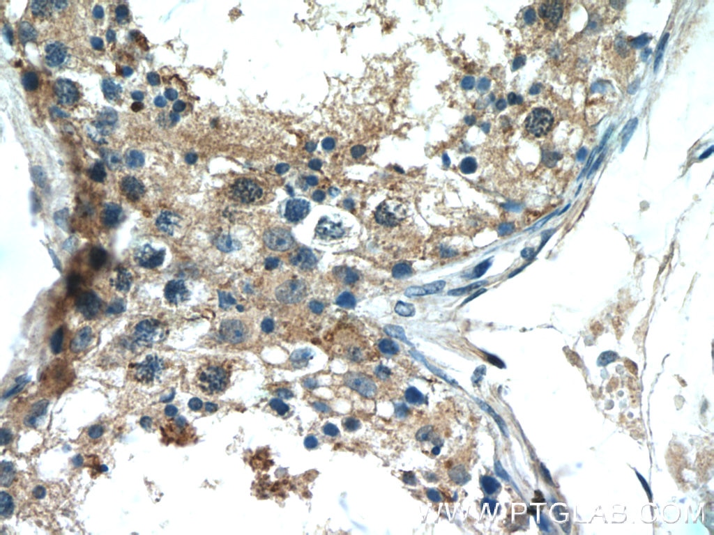 Immunohistochemistry (IHC) staining of human testis tissue using ERMP1 Polyclonal antibody (17321-1-AP)